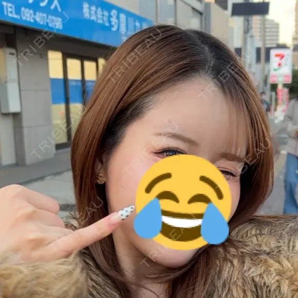 糸リフト 城本クリニック 福岡院 BEFORE メイン用