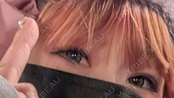 二重埋没 湘南美容クリニック 千葉センシティ院 BEFORE メイン用