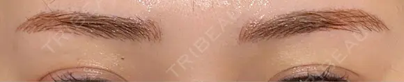 アートメイク（眉） G MEDICAL ART クリニック 新宿院 BEFORE メイン用