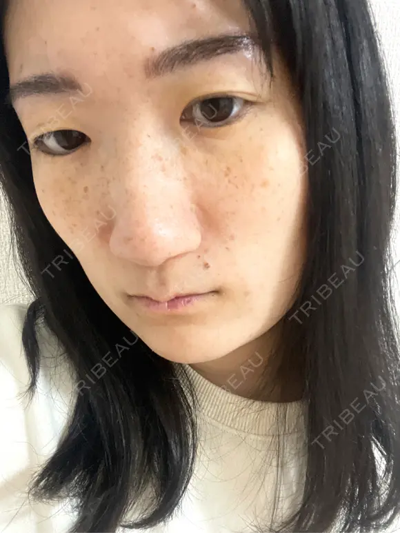 アートメイク（眉） G MEDICAL ART クリニック 新宿院 BEFORE メイン用