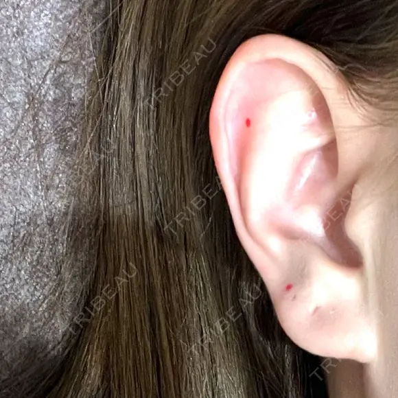 ピアス穴あけ 渋谷美容外科クリニック 新宿院 BEFORE メイン用