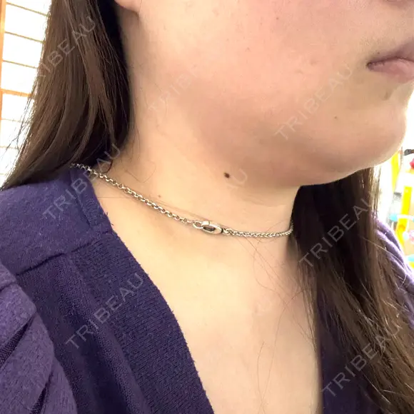 脂肪溶解注射（顔） ルラ美容クリニック 横浜院 BEFORE メイン用