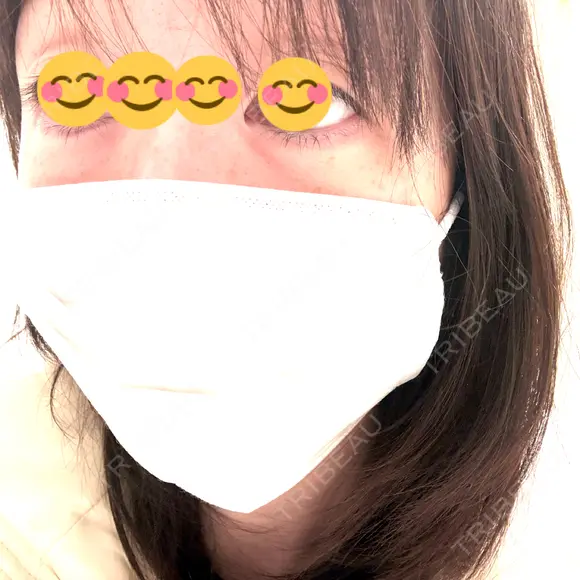 クマ治療 / 下まぶたたるみ取り / 下まぶたの脂肪取り 千葉美容外科アイビークリニック BEFORE メイン用