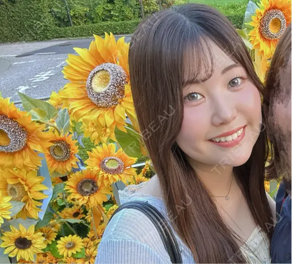 糸リフト / 脂肪吸引（顔） / ジョールファット除去 / ヒアルロン酸注入（あご） / ボトックス（エラ・小顔） 新宿美容外科ネビュラクリニック BEFORE メイン用