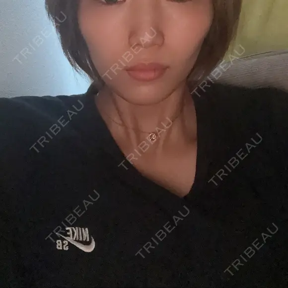 糸リフト / ボトックス（あご） / 肌ヒアルロン酸注入（たるみ・シワ改善） / ボトックス（ガミースマイル） ルラ美容クリニック 池袋院 BEFORE メイン用