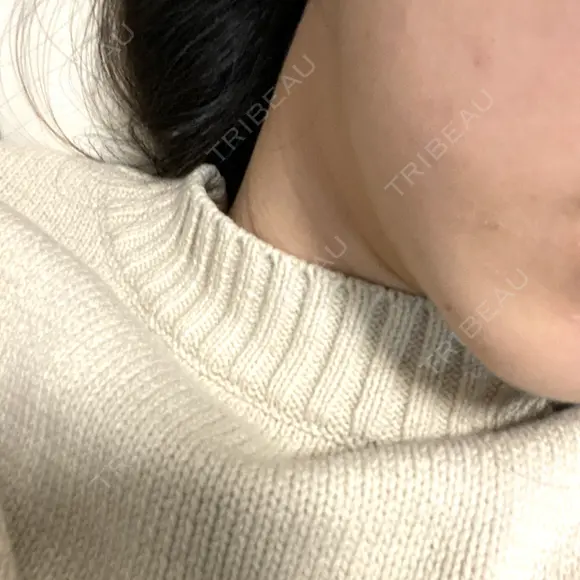 ハイフ（顔） 表参道メディカルクリニック 福岡天神院 BEFORE メイン用