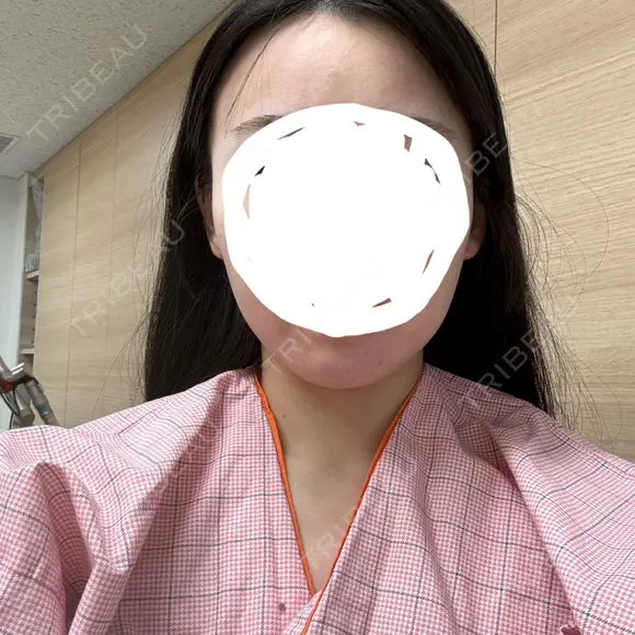 糸リフト / 脂肪吸引（顔） 渋谷美容外科クリニック 渋谷院 BEFORE メイン用