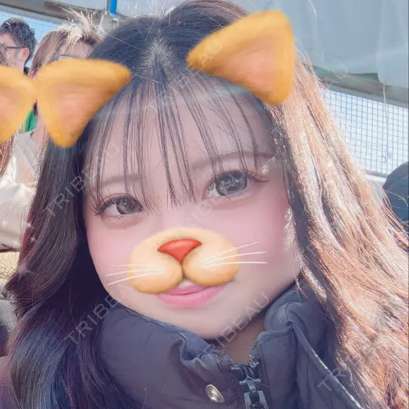 二重埋没 / 二重切開 / 目頭切開 / 上まぶたたるみ取り / 上まぶたの脂肪取り 新宿美容外科ネビュラクリニック BEFORE メイン用