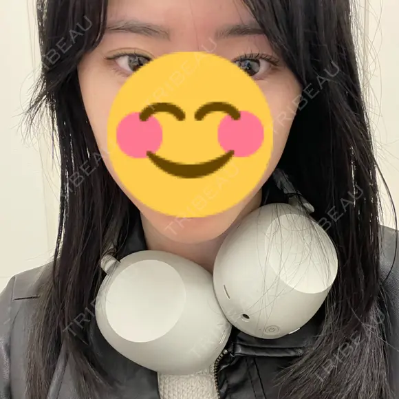 ボトックス（エラ・小顔） ルラ美容クリニック 京都院 BEFORE メイン用