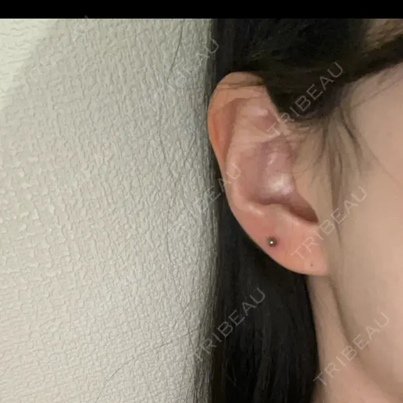 ピアス穴あけ 美容皮膚科エルムクリニック 京都院 BEFORE メイン用