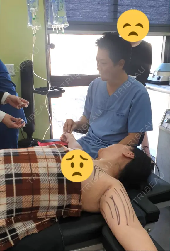 脂肪吸引（脚） REX整形外科 BEFORE メイン用