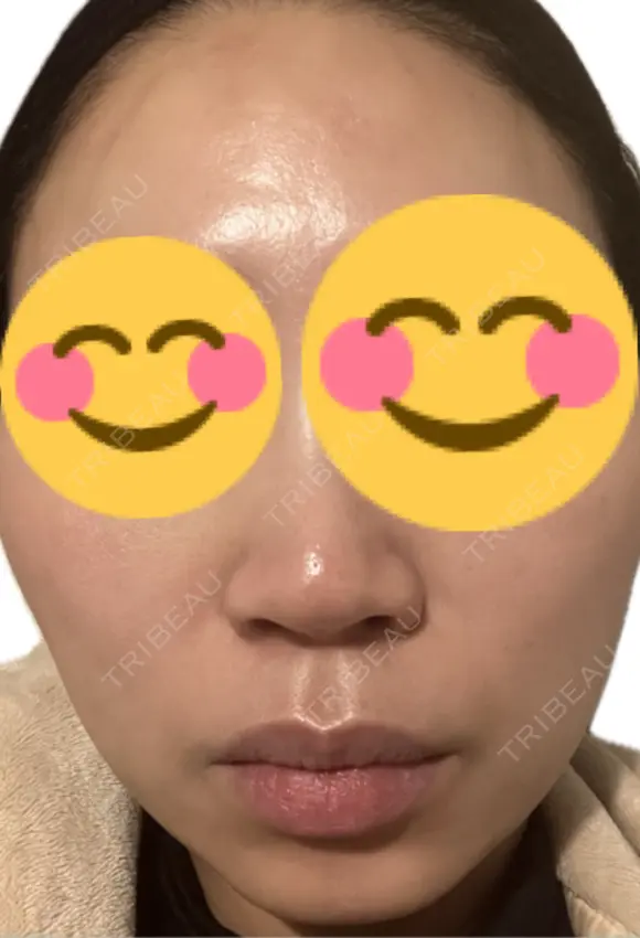 ルメッカ La Fee Clinic BEFORE メイン用