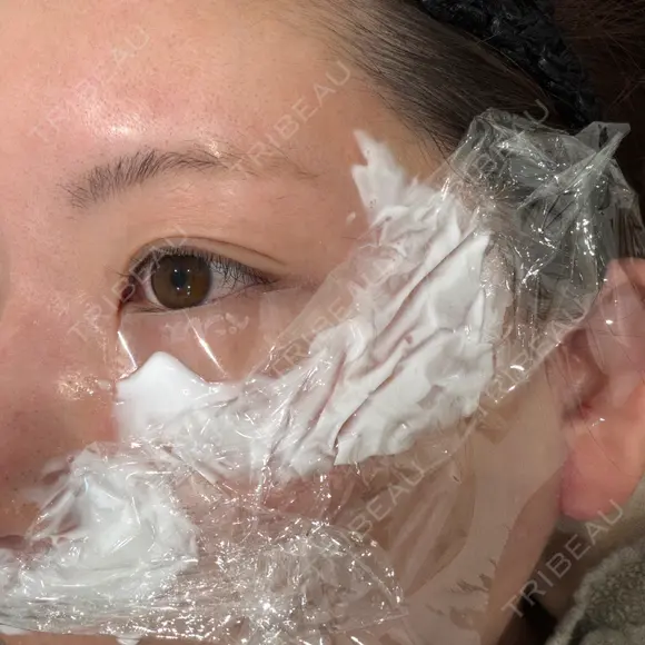 水光注射（ハリ・美肌） GLAMRULE CLINIC (グラムルール クリニック) 銀座院 BEFORE メイン用