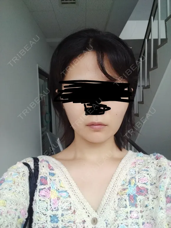 白玉点滴・注射 Aya Beauty & Family Clinic大阪院 BEFORE メイン用
