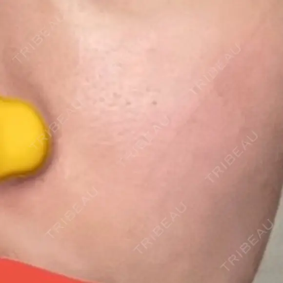肌育注射（ジュベルックなど） / イオン導入 / 光治療（フォトフェイシャルなど） / ルメッカ Belle Via Clinic BEFORE メイン用