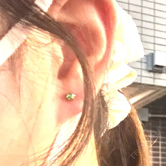ピアス穴あけ 新宿ラクル美容外科クリニック 新宿院 BEFORE メイン用