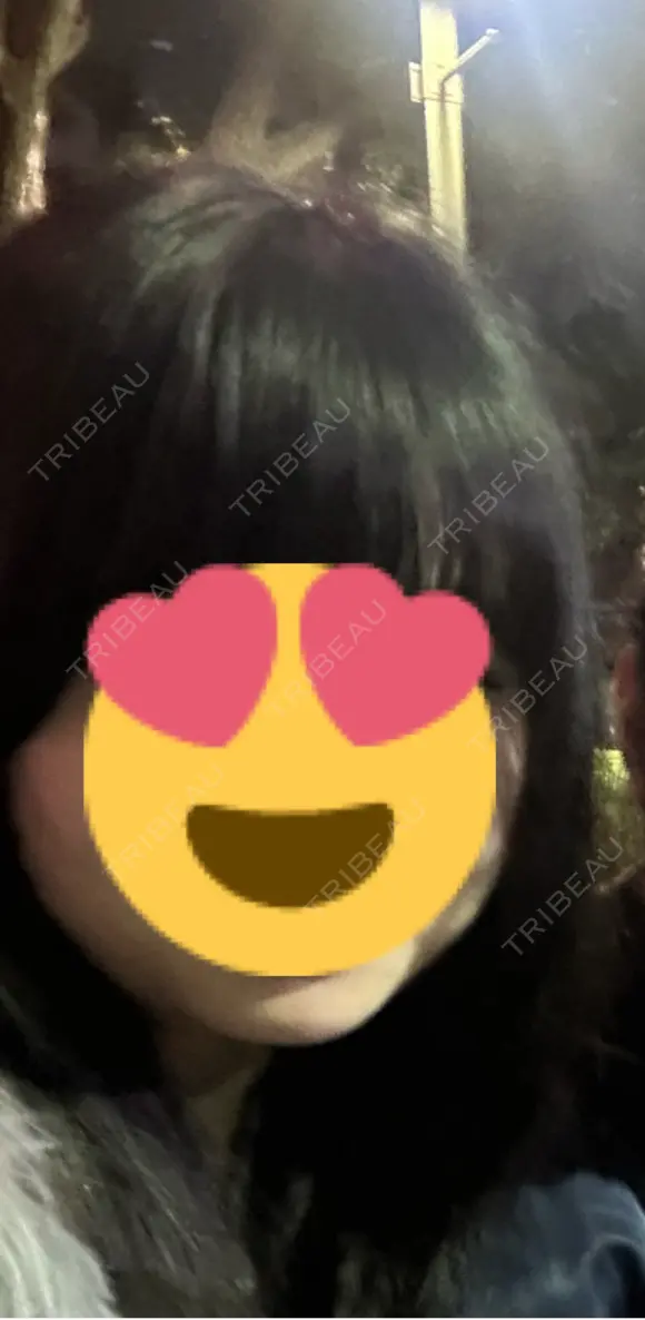 脂肪吸引（顔） R Beauty CLINIC 銀座院 BEFORE メイン用