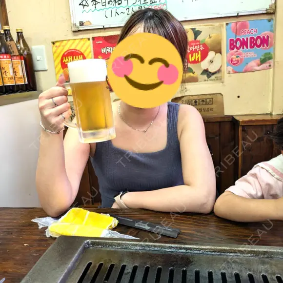 脂肪吸引（二の腕） / 脂肪吸引（お腹） / 脂肪吸引（腰） / 脂肪吸引（背中） / 脂肪吸引（肩） GAYA body design clinic BEFORE メイン用