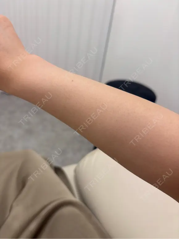 白玉点滴・注射 Aya Beauty & Family Clinic大阪院 BEFORE メイン用