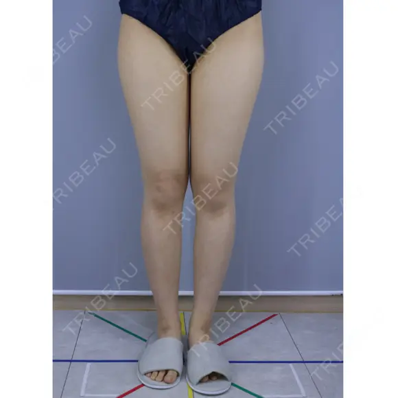 その他 GINI CLINIC（ジニクリニック） BEFORE メイン用