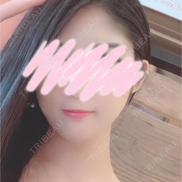 ボトックス（口角） / ハイフ（顔） Original Beauty Clinic GINZA BEFORE メイン用