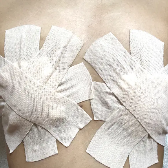 その他（胸） 三輪皮フ科形成外科 BEFORE メイン用