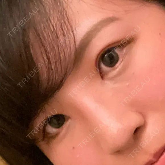 アートメイク（眉） BMC CLINIC 南青山 BEFORE メイン用