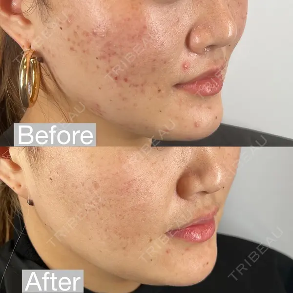 oneUPclinicの症例