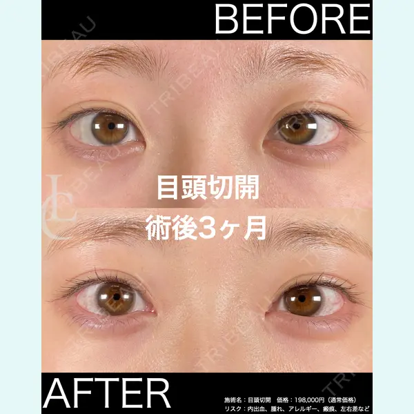 LIBER CLINIC 矢橋 洋一郎医師の症例