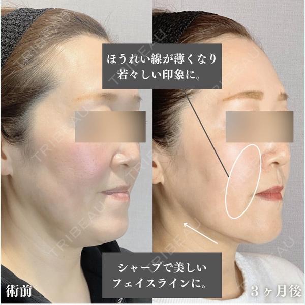 東京美容医療クリニック 池袋院 一条 英里医師の症例