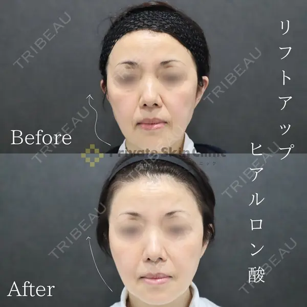 プライベートスキンクリニック 梅田本院の症例