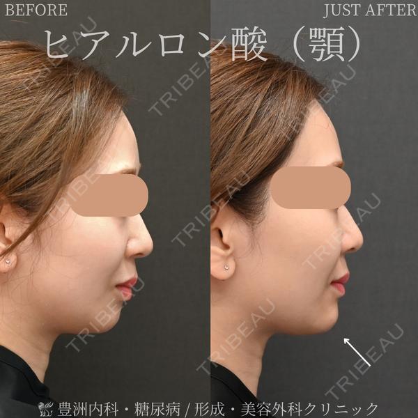 豊洲内科・糖尿病 / 形成・美容外科クリニック 澤口 悠医師の症例