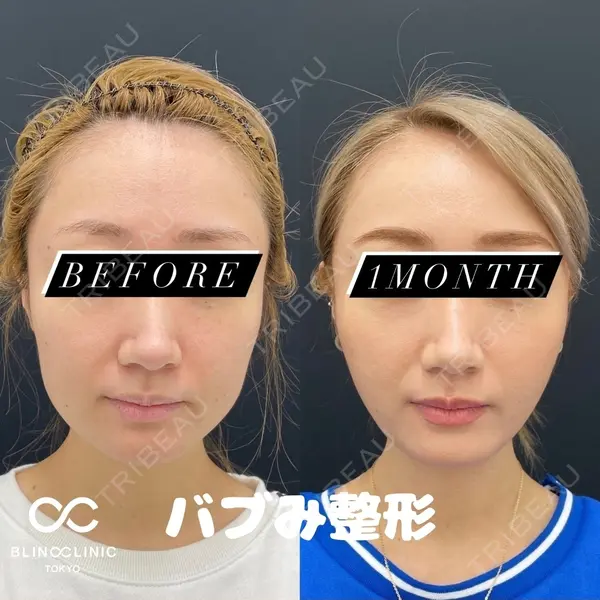BLINC CLINIC （ブリンク クリニック）の症例