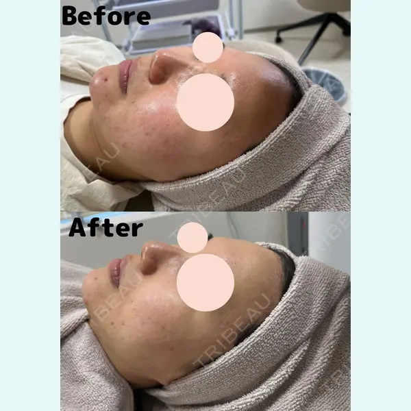 アマリラビューティークリニック 川路 智子医師の症例