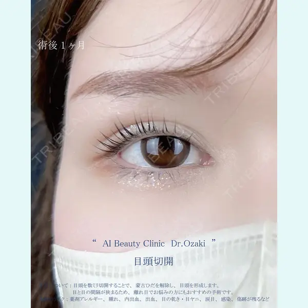 AI Beauty Clinic （エーアイ美容クリニック） 尾崎 宥文医師の症例