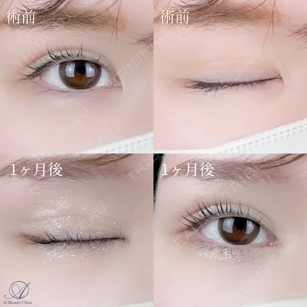 AI Beauty Clinic （エーアイ美容クリニック） 尾崎 宥文医師の症例