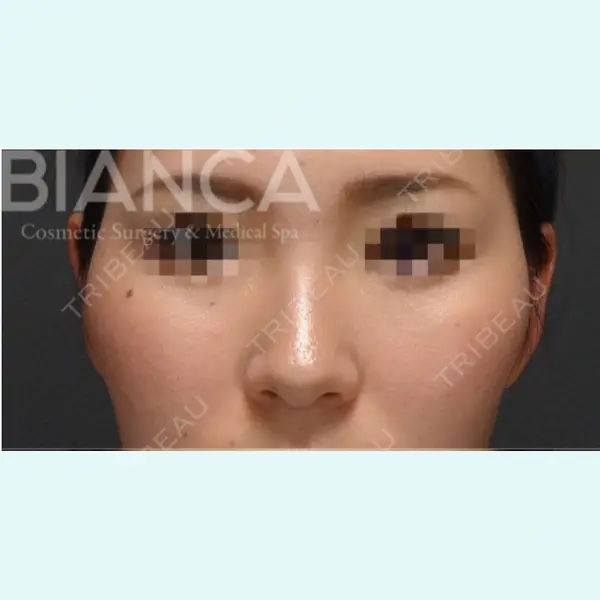 BIANCA銀座 堀田 和亮医師の症例