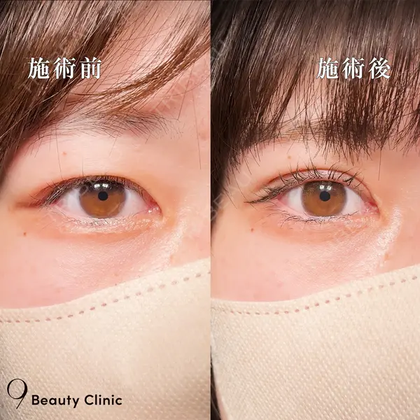 9BeautyClinic 池田 陸医師の症例