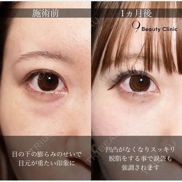 9BeautyClinic 池田 陸医師の症例