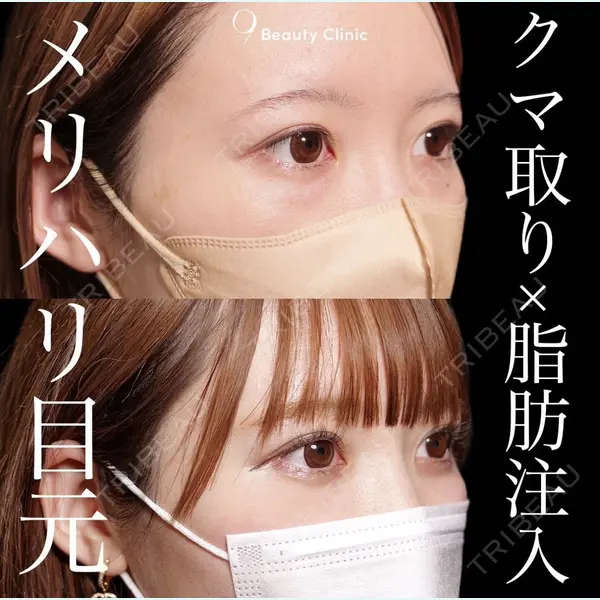 9BeautyClinic 池田 陸医師の症例