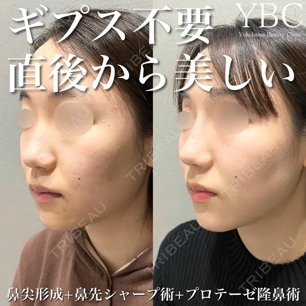 YBC横浜美容外科 池袋院 磯村 亮輔医師の症例