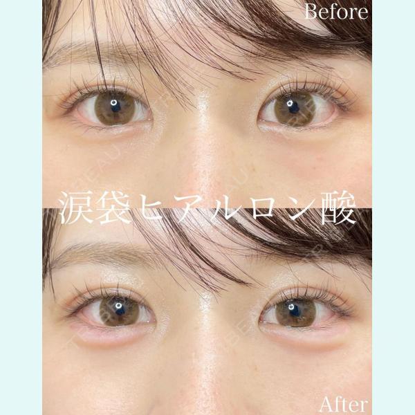 ルラ美容クリニック 大阪本院の症例