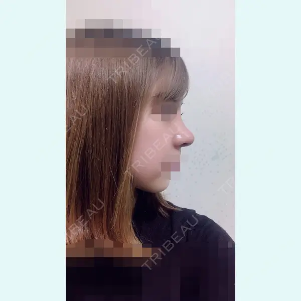 加美（GAMI）整形外科 パク・ゴヌク医師の症例