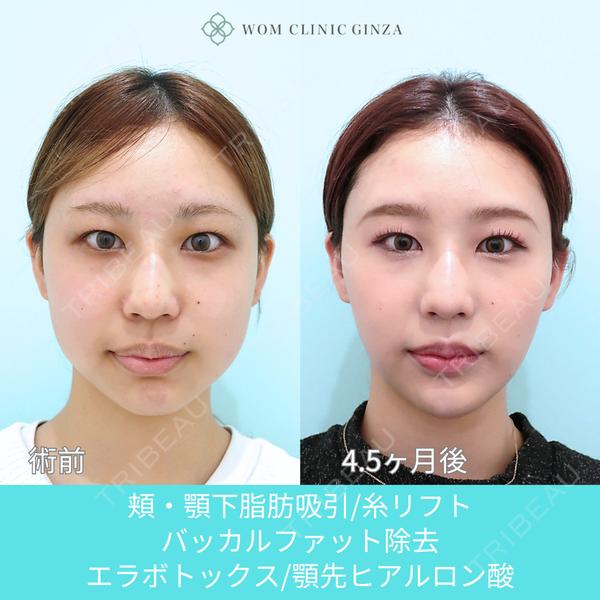 WOM CLINIC GINZA （ワム クリニック ギンザ） 深堀 純也医師の症例