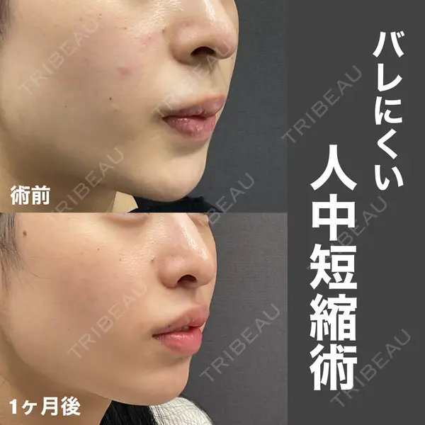 ゆきスキンクリニック 東池袋 小林 智之医師の症例