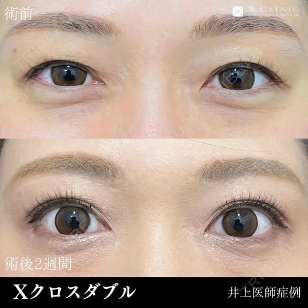 X CLINIC 名古屋院 井上 忠俊医師の症例