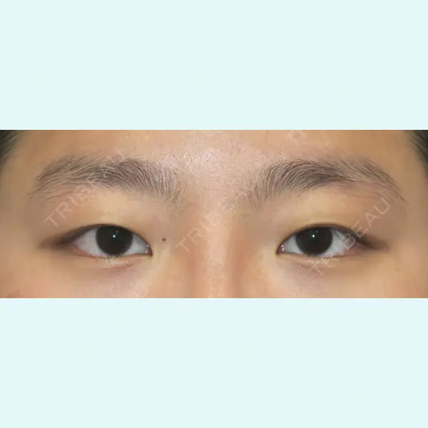 銀座S美容・形成外科クリニック 酒井 直彦医師の症例