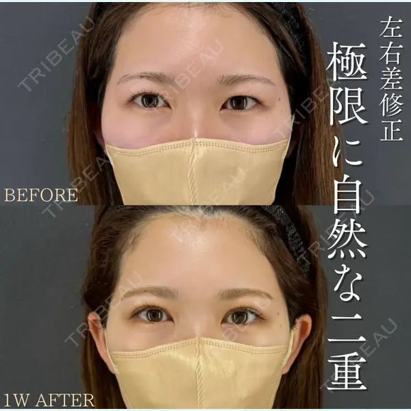 X CLINIC 恵比寿院 北尾 善杜医師の症例