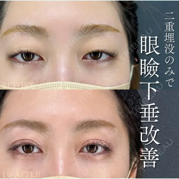 X CLINIC 恵比寿院 北尾 善杜医師の症例