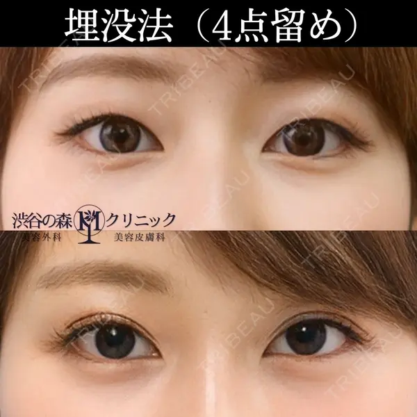 渋谷の森クリニック 藤井　美香子医師の症例